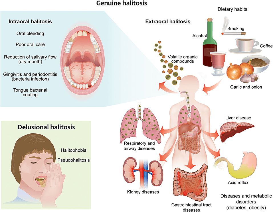Eliminating Bad Breath From Lung Origins
