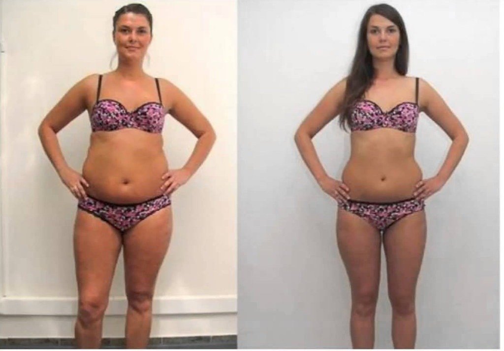 Before and After