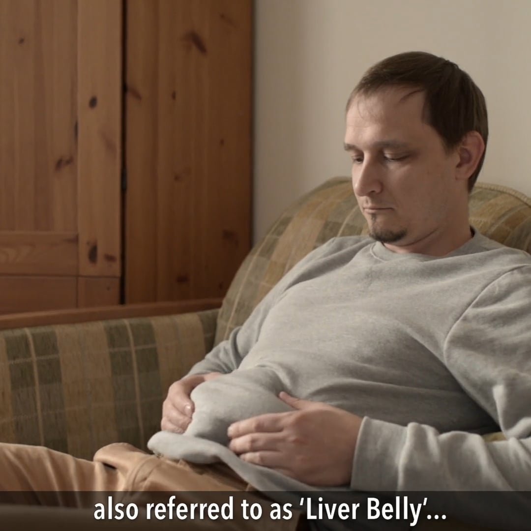 Exploring the Benefits of Liv Pure Supplements