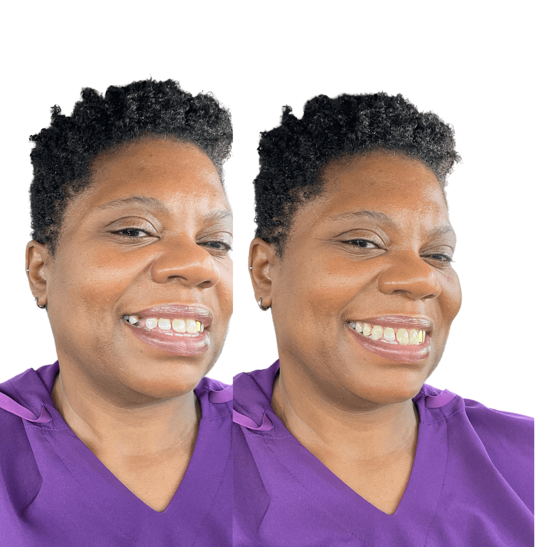 ProDentim: New Breakthrough for Gum Support and Bad Breath Relief